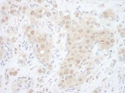 Immunohistochemistry-Paraffin: EYA2 Antibody [NBP1-46816]