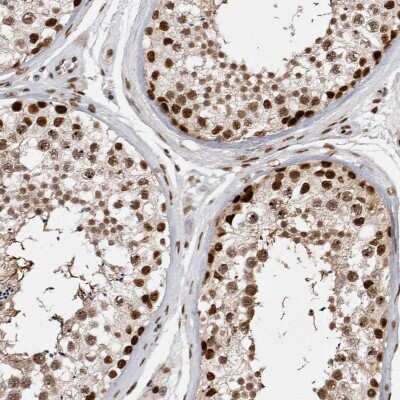 Immunohistochemistry-Paraffin: EYA2 Antibody [NBP1-84026]