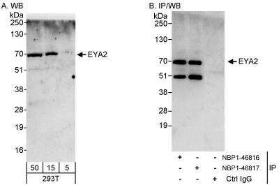 Western Blot: EYA2 Antibody [NBP1-46817]