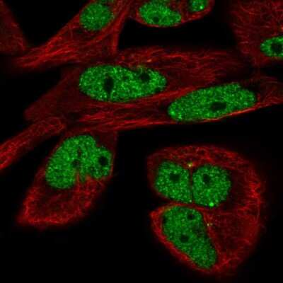 Immunocytochemistry/ Immunofluorescence: EYA3 Antibody [NBP2-57061]