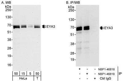 Western Blot: EYA3 Antibody [NBP1-46818]