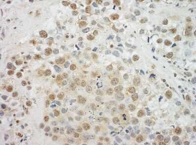 Immunohistochemistry: EYA4 Antibody [NBP1-41100]