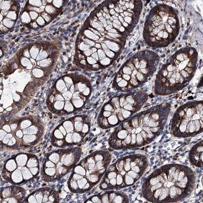 Immunohistochemistry-Paraffin: EYA4 Antibody [NBP1-85546]