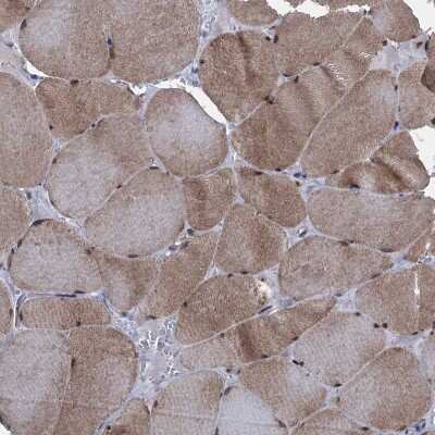 Immunohistochemistry-Paraffin: EYA4 Antibody [NBP1-85546]