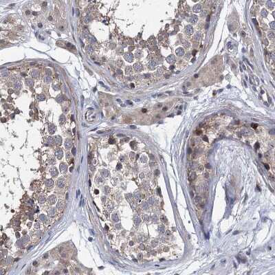 Immunohistochemistry-Paraffin: EYA4 Antibody [NBP1-85546]