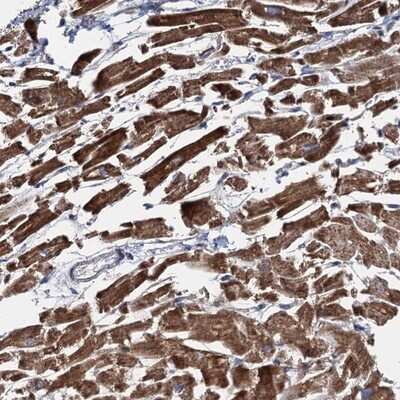 Immunohistochemistry-Paraffin: EYA4 Antibody [NBP1-85547]