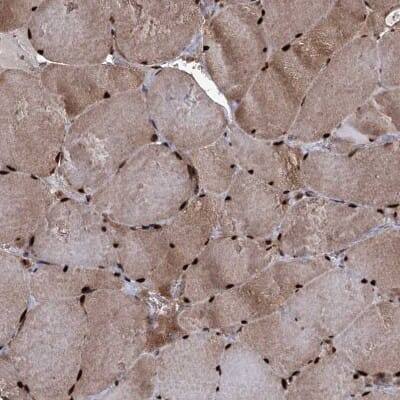 Immunohistochemistry-Paraffin: EYA4 Antibody [NBP1-85548]