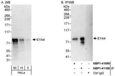 Western Blot: EYA4 Antibody [NBP1-41100]