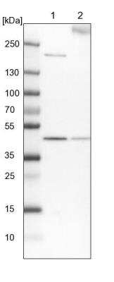 Western Blot: EYA4 Antibody [NBP1-85546]