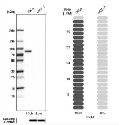 Western Blot: EYA4 Antibody [NBP1-85547]