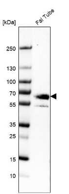 Western Blot: EYA4 Antibody [NBP1-85548]