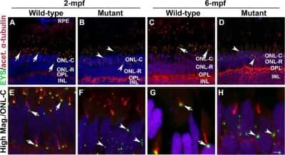 Immunocytochemistry/ Immunofluorescence: EYS/RP25 Antibody [NBP1-90038]