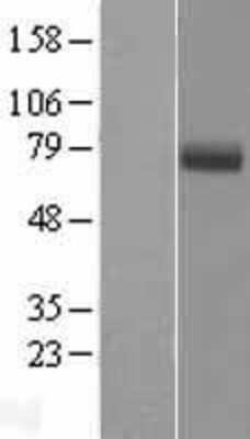 Western Blot: EYS/RP25 Overexpression Lysate [NBP2-04720]