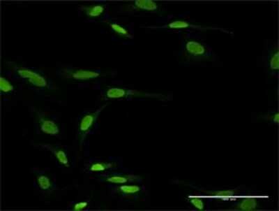 Immunocytochemistry/ Immunofluorescence: EZFIT/ZNF71 Antibody [H00058491-D01P]
