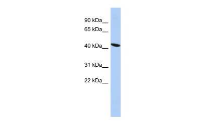 Western Blot: EZFIT/ZNF71 Antibody [NBP1-80358]