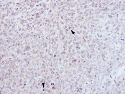 Immunohistochemistry-Paraffin: EZH1 Antibody [NBP1-32111]