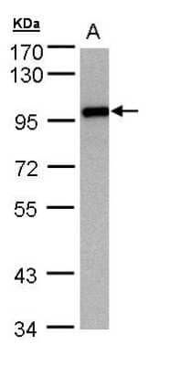 Western Blot: EZH1 Antibody [NBP1-32111]