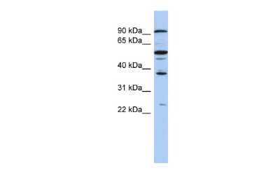 Western Blot: EZH1 Antibody [NBP2-87385]