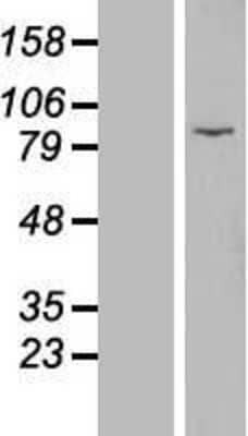 Western Blot: EZH1 Overexpression Lysate [NBL1-10398]