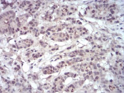 Immunohistochemistry: EZH2/KMT6 Antibody (6G4F4) - BSA Free [NBP2-52463]