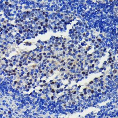 Immunohistochemistry-Paraffin: EZH2/KMT6 Antibody (9Q2R9) [NBP3-15783]