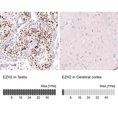 Immunohistochemistry-Paraffin: EZH2/KMT6 Antibody (CL11960) [NBP3-15125]