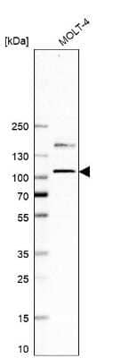 Western Blot: EZH2/KMT6 Antibody (CL11960) [NBP3-15125]