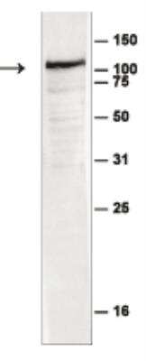 Western Blot: EZH2/KMT6 Antibody [NBP2-59251]