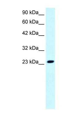 Western Blot: Eaf6 Antibody [NBP1-91523]