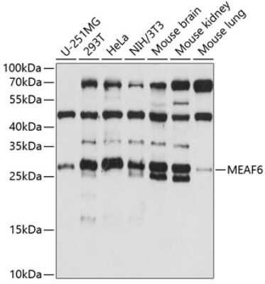 Western Blot: Eaf6 AntibodyAzide and BSA Free [NBP3-03319]