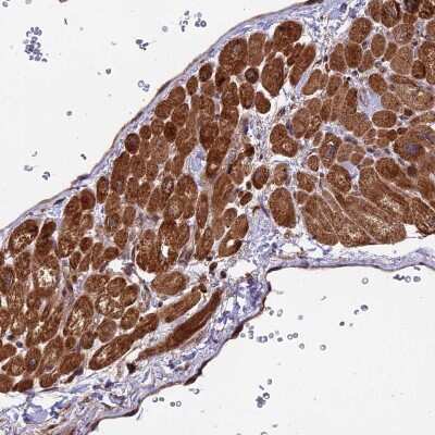 Immunohistochemistry-Paraffin: Eco1 Antibody [NBP1-87957]