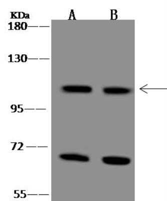 Western Blot: Eco1 Antibody [NBP3-12655]