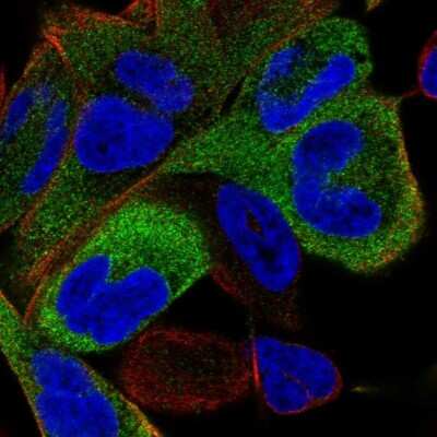 Immunocytochemistry/ Immunofluorescence: Eg5 Antibody [NBP2-58929]
