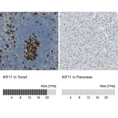 Immunohistochemistry-Paraffin: Eg5 Antibody [NBP1-84887]