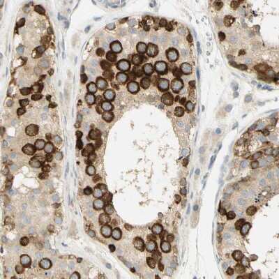 Immunohistochemistry-Paraffin: Eg5 Antibody [NBP1-84887]