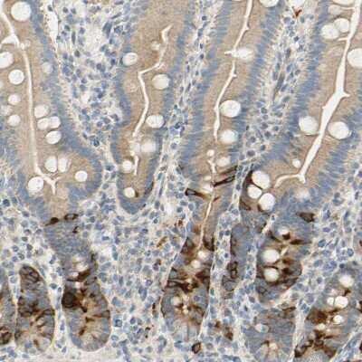Immunohistochemistry-Paraffin: Eg5 Antibody [NBP1-84887]