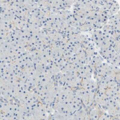 Immunohistochemistry-Paraffin: Eg5 Antibody [NBP1-84887]