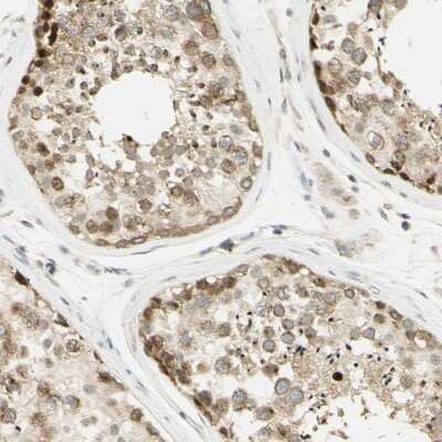 Immunohistochemistry-Paraffin: Eg5 Antibody [NBP1-84888]