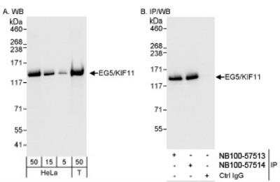 Western Blot: Eg5 Antibody [NB100-57514]