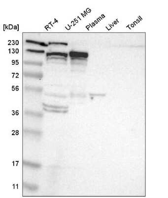 Western Blot: Eg5 Antibody [NBP2-58929]