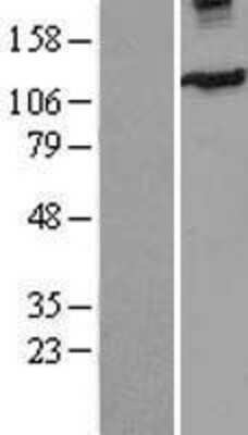 Western Blot: Eg5 Overexpression Lysate [NBL1-12284]