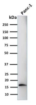 Western Blot: Elastase Antibody (CELA3B/1218) [NBP2-44812]