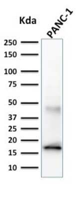 Western Blot: Elastase Antibody (CELA3B/1257)Azide and BSA Free [NBP2-54301]