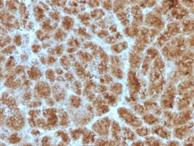 Immunohistochemistry-Paraffin: Elastase Antibody (CELA3B/1257) [NBP2-53246]
