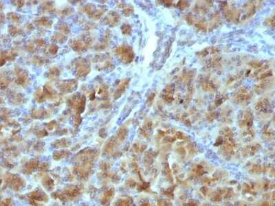 Immunohistochemistry-Paraffin: Elastase Antibody (CELA3B/1257) [NBP2-53246]