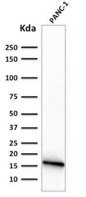 Western Blot: Elastase Antibody (CELA3B/1374) [NBP2-53285]