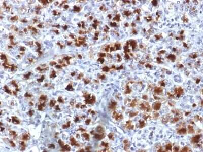 Immunohistochemistry-Paraffin: Elastase Antibody (CELA3B/1757) - Azide and BSA Free [NBP2-54491]