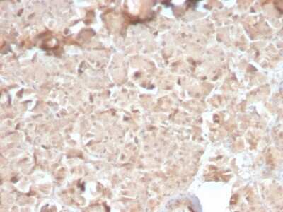 Immunohistochemistry-Paraffin: Elastase Antibody (CELA3B/2810R) [NBP3-07574]