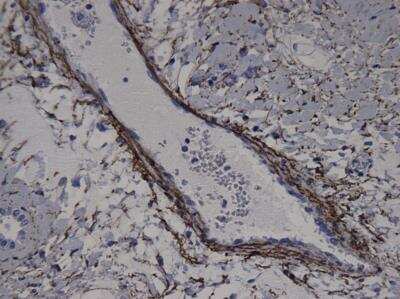 Immunohistochemistry-Paraffin: Elastin Antibody (BA-4) [NB100-2076]