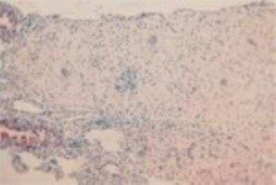 Immunohistochemistry-Paraffin: Elastin Antibody (BA-4) [NB100-2076]